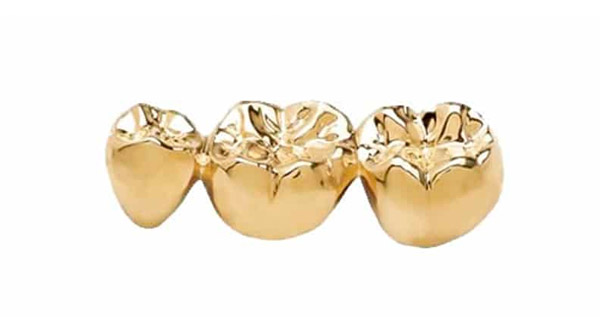 sell-dental-gold-for-cash-nw-suburbs-illinois