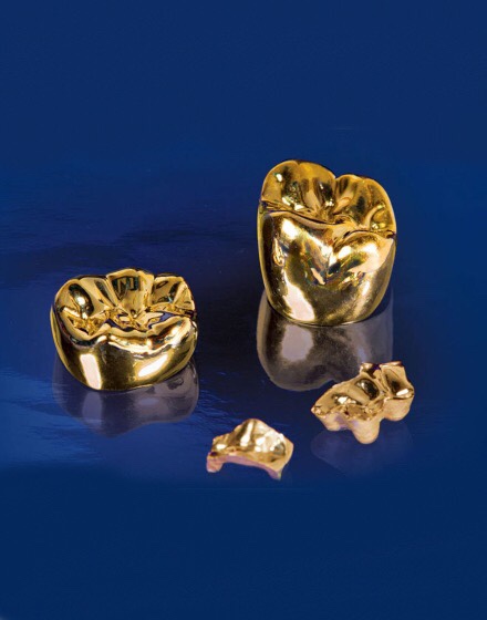Sell your dental gold with PGS gold and coin for top dollar.